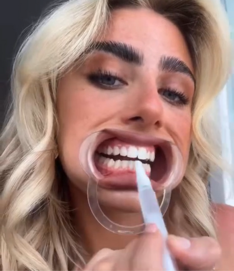 Teeth whitening pen 