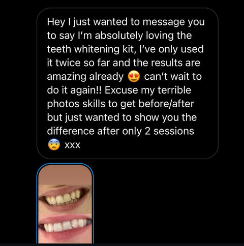 Teeth Whitening Kit